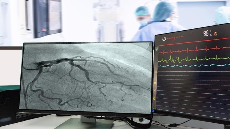 Cardiac Catheterization Procedure