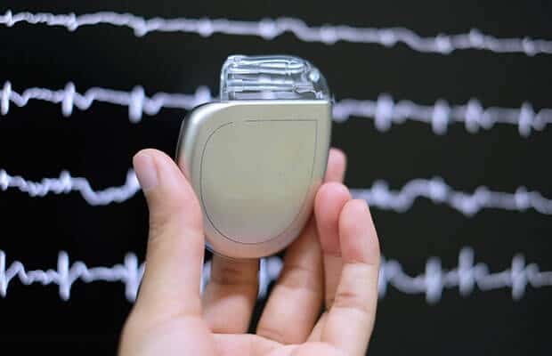 Implantable Defibrillator (ICD) Placement
