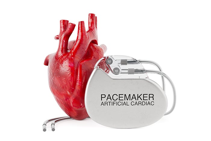Permanent pacemaker placement procedure