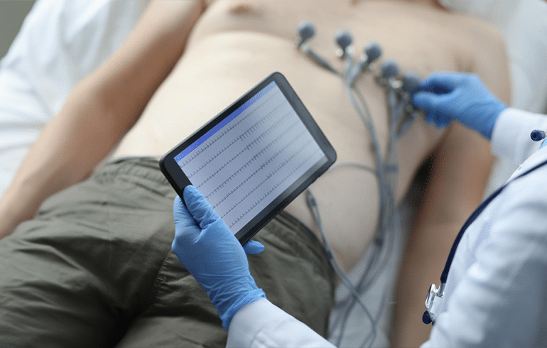 Electrocardiogram EKG